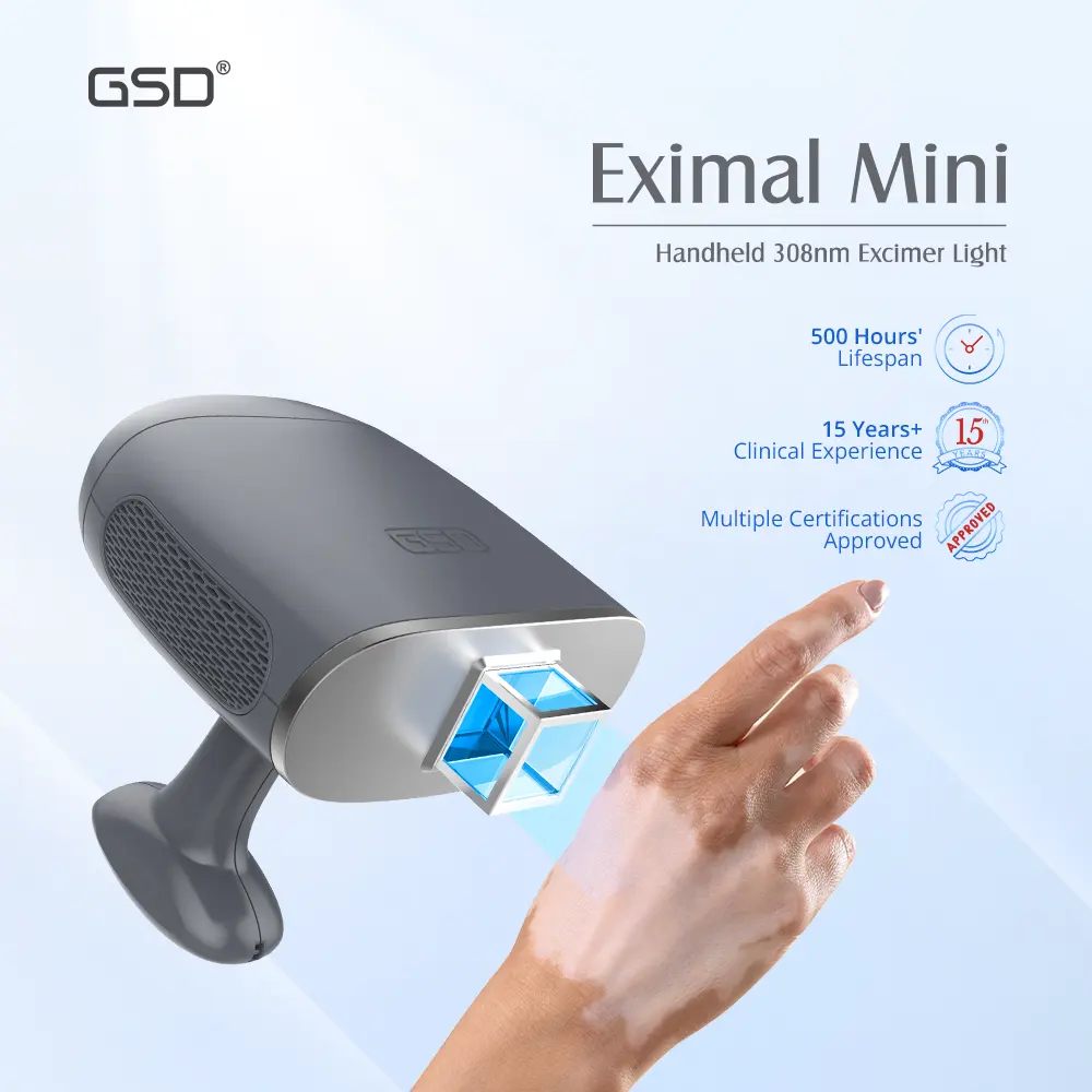 Mini laser portátil gsd, aparelho de laser portátil 308nm para psoríase e vitiligo