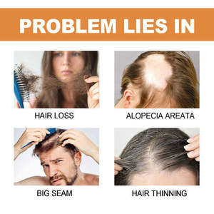 Yeni tasarım özel etiket Ogranic saç büyüme Serum saç çıkma ampul tedavisi besleyici ve saç dökülmesi önleme - Product Image 6