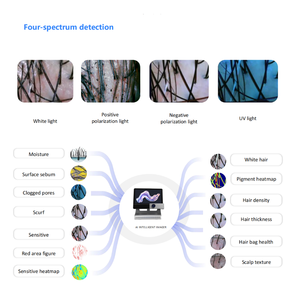 Ai kỹ thuật số da tóc phân tích da Đầu HD kính hiển vi Thiết bị phân tích tóc thông minh ai thông minh phân tích da đầu - Product Image 5