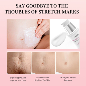 OEM ODM Organic Beste Schwangerschaft Anti-Falten-Schönheits aufhellung Feuchtigkeit spendend Glatt Entfernen Sie die Narben entfernung Anti-Stretch-Mark-Creme - Product Image 3