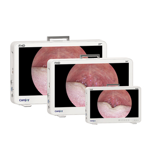 Camjoy CF927 sistem kamera endoskopi Portabel medis untuk ureteroskop Semi kaku - Product Image 2