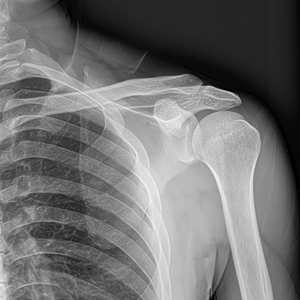 <strong>Matching</strong> with CR, DR System 17*17 Inch Digital X Ray <strong>Flat</strong> Panel Detector - Product Image 5