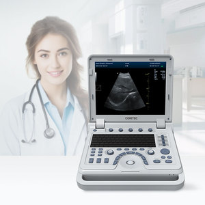 CONTEC CMS1700Aプロの医療機器ecografoカラードプラー超音波 - Product Image 3