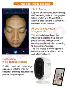 Analizador de piel facial 3D AI con pantalla de 15,6 pulgadas, máquina de escáner facial con espejo mágico para análisis de piel en varios idiomas para uso comercial