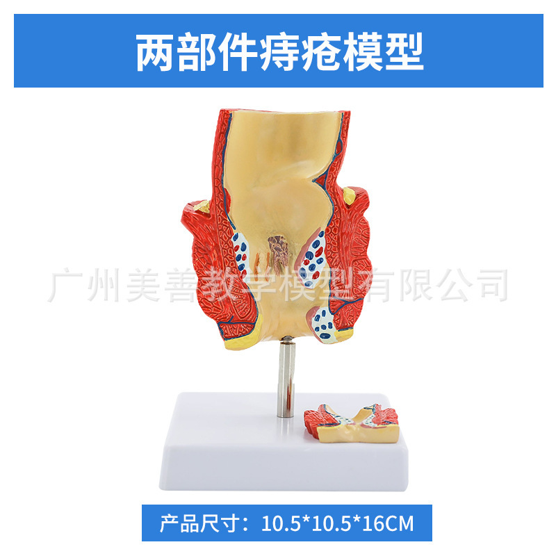 Pathology of rectal hemorrhoids - Part 2