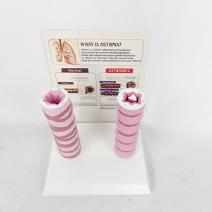 Comparison Model of Normal and Diseased Trachea in the Human Body with Comprehensive <strong>Explanation</strong> Base Medical Science Product - Product Image 3