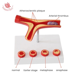 Human Pathology Blood Vessel Model Medical Anatomical Artey Model Medical Teaching Blood Vessels Model - Product Image 2