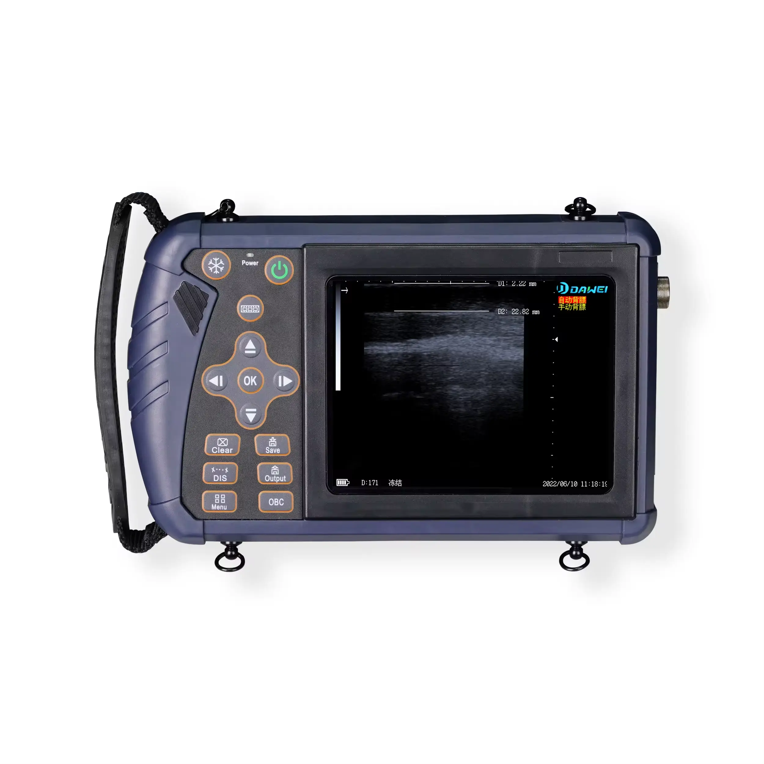 Máquina de ultrasonido de imágenes de alta calidad Dawei, precio de granja de ganado, equipo de escáner de embarazo, latidos cardíacos fetales de vaca