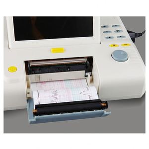 Chất lượng cao bệnh nhân màn hình xe đẩy y tế giỏ hàng di động xe đẩy y tế cho bệnh nhân màn hình - Product Image 4