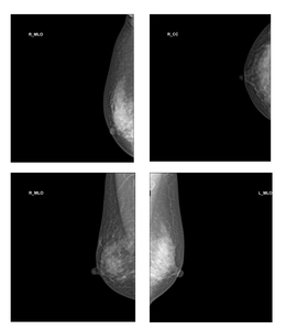 Máquina da mamografia Raio X/máquina diagnóstica médica das doenças mamárias da glândula - Product Image 5