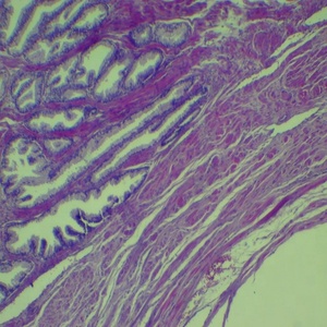 Teaching <strong>Microscope</strong> Human Pathology <strong>Slides</strong> (100pcs) - Product Image 5