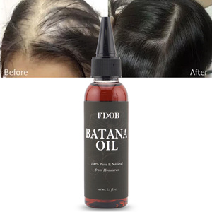 สินค้าขายดีเจริญเติบโตของเส้นผม ส่งเสริมสุขภาพของเส้นผมสําหรับผู้ชายผู้หญิง เพิ่มความสดใสของเส้นผมและผิวด้วยน้ํามันบาทาน่า - Product Image 2