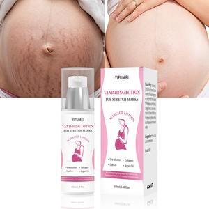OEM ODM Organic Beste Schwangerschaft Anti-Falten-Schönheits aufhellung Feuchtigkeit spendend Glatt Entfernen Sie die Narben entfernung Anti-Stretch-Mark-Creme - Product Image 1