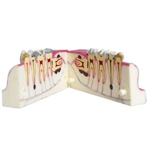 Wisdom Tooth Tissue Disassembly Model for Right Lower Posterior Teeth Oral Cavity Anatomy <strong>Explanation</strong> Medical Science Product - Product Image 5