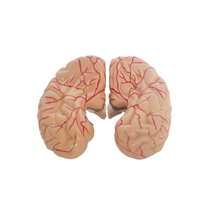Medizinische Lehre Human Anatomy Brain Model mit Arterien PET-Material - Product Image 4