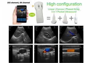 B26F <strong>the</strong> Highest 64 Channel 3 in 1 Handheld Wireless and Wired Color Doppler Ultrasound Scanner Probe for Windows IOS Android - Product Image 2