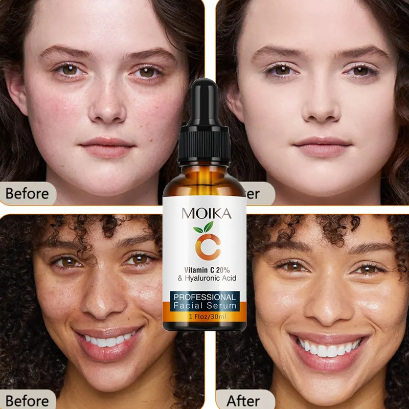 DOLANJN OEM marca privada cuidado de la piel suero blanqueador Facial VC orgánico puro con 20% suero de vitamina C antienvejecimiento para la cara
