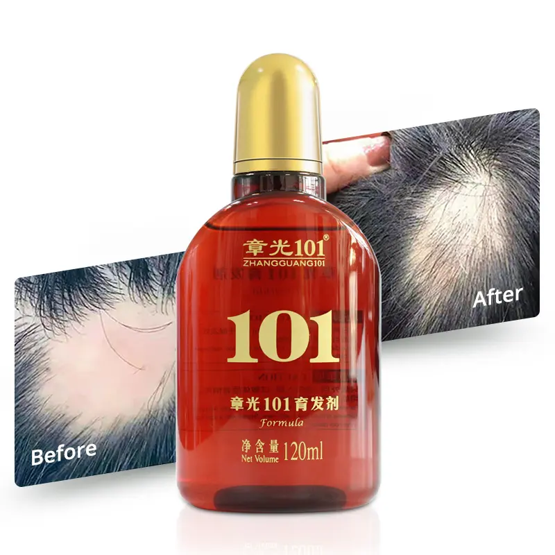 Zhangguang 101 Anti Haaruitval Alopecia Behandeling Haargroei Olie