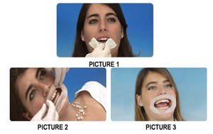 Ta015 zogear 100% cao su tự nhiên nha khoa má rút lại, eo khử trùng miệng mở, miệng giãn nở - Product Image 5