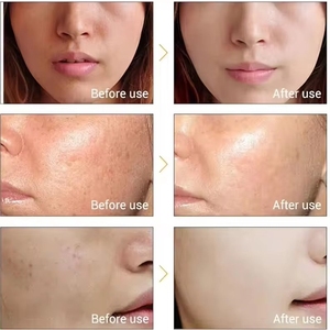 Glutathion Koji säure Serum Vitamin C Aufhellende Sommersprossen Entfernen von Gesichts serum Aufhellung behandlung OEM/ODM - Product Image 6