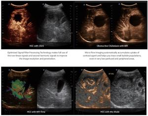 Ultrason probu ile minultrasound ultrason makinesi SonoScape <span class=keywords><strong>S60</strong></span>