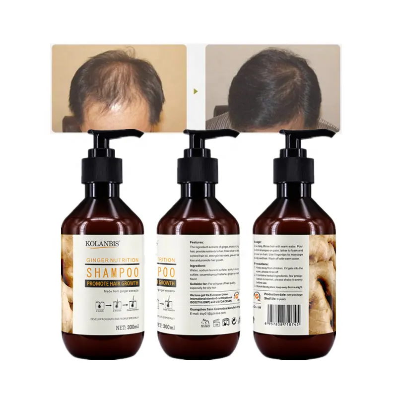 Worthbuy — shampoing antichute aux herbes de gingembre, meilleur produit de traitement pour la calvitie, pas de médicaments