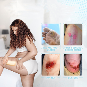 เคลือบโฟมซิลิโคนกันน้ําขนาดใหญ่พร้อมขอบกาว ผ้าพันแผลดูแลแผลดูดซับสูง - Product Image 5