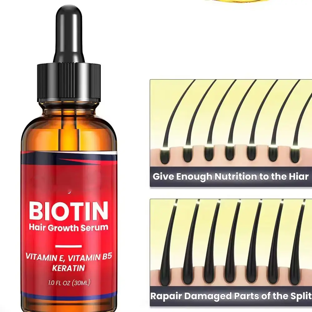 Chống rụng tóc Điều trị huyết thanh gừng dầu Huyết thanh tóc mọc lại chăm sóc vitamin B5 Biotin tóc tăng trưởng huyết thanh dầu cho nam giới và phụ nữ
