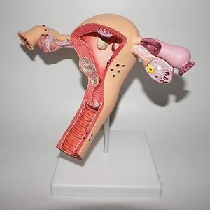 教育学習ツール婦人科子宮構造解剖学モデル人間の病理学的子宮モデル女性の繁殖組織 - Product Image 3