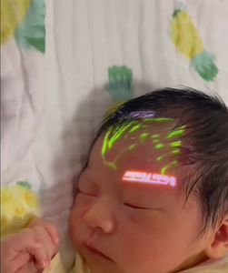 Vf12 דק נייד עבור גלאי ורידים מילוי עבור paediatary הזרקה תוך ורידי בוגר neonatal - Product Image 5