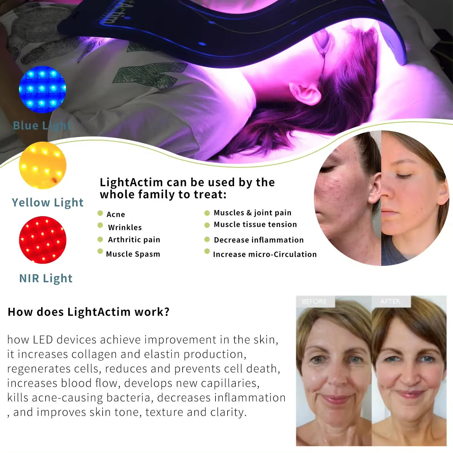 CELLUMA ธรรมชาติ PDT LED เครื่องบําบัด Photodynamic กําจัดริ้วรอยโคมไฟดูแลผิวหน้า Chromotherapy สปาฟื้นฟูผิว