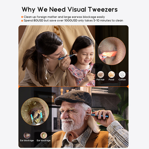 Bebird Note5 Pro 3-in-1 aile doktor Mini otoskop kamera ile ağrısız kulak temizleyici aracı - Product Image 4