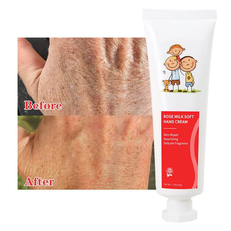 Private Label Reparação Creme Para Maos Para Secas mãos rachadas Whitening Hidratante Hand Cream Mel Suavização Rose Hand Cream