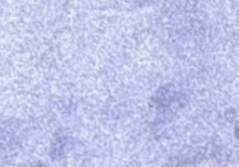 Uva Morada