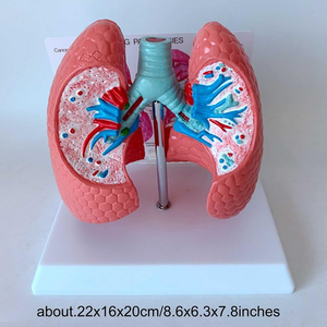 Comparison Lung Model Between Human Smoking and Drug Lung Model for Teaching Use <strong>Explanation</strong> in Hospital - Product Image 4