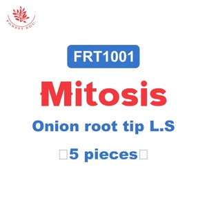 תא הצמח mitosis frt1001 קצה שורש בצל לזהות את מורפולוגיה, המיקום ומספר הכרומוזומים בתאים