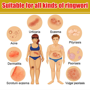 Smmlpunoem Pi kangwang Kem giảm đau da ướt ngứa Kem chống ngứa cho chợ đêm bán hàng bán buôn thương mại điện tử douyin - Product Image 2