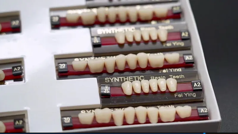 Pmma prostheses dental sintético polímero, resina acrílica