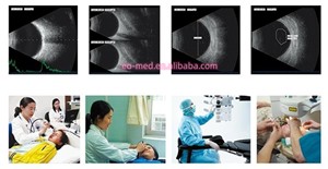 EUS500T Factory Price Laptop A/B Ophthalmic LED Ultrasound Scanner for Biometry Eye <strong>Test</strong> in Ophthalmology - Product Image 6
