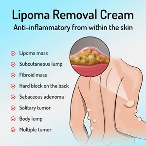 Hot Sale Lymphatic Detox Massage Cream Whitening & Soothing Fat Lump & Lipoma Removal for Body - Product Image 6