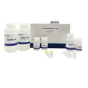 Hızlı arındırmak yüksek kaliteli kan genomik DNA arıtma kitleri kan DNA Mini kiti (<1ml) - Product Image 2