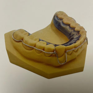 Peralatan fungsional ortodontik gigi Model gigi dan kkel/Hawley/ Nance/ TPA/ Twin-Block/bungkus/retainer Set - Product Image 4