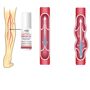 Günlük kullanım sodyum Aescinate bacak jeli-dolaşımını artırır, varisli ven semptomlarını (Heaviness, şişme) hafifletir, hızlı emici - Product Image 1