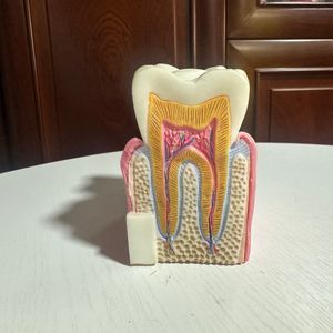 Model gigi PVC manekin untuk kerusakan soptur gigi tiruan proses pengajaran peralatan pendidikan untuk praktek medis dokter gigi - Product Image 4