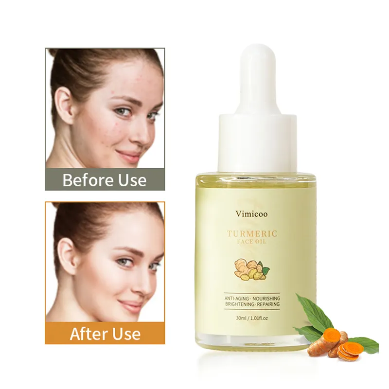 Personalizar Private Label Orgânico Natural Brightening Anti Acne Anti-Oxidação Rosehip Cúrcuma Face Oil
