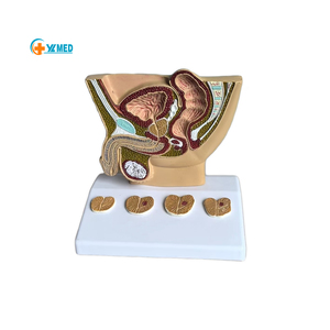 Adult Male Abdominal Bladder Prostate Anatomy Prostate Health Pathological Comparison Doctor-patient <strong>Explanation</strong> Model - Product Image 1