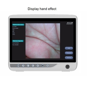 Bán buôn Hot Bán máy móc tiên tiến gastroscope nội soi thú y nội soi Camera dog cho Pet bệnh viện - Product Image 2