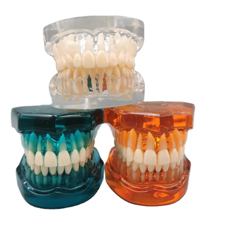 Modelo de dientes de enseñanza Dental de implante dental YP para práctica odontología dientes modelo de diente de dentadura estándar molde modelo de cristal transparente