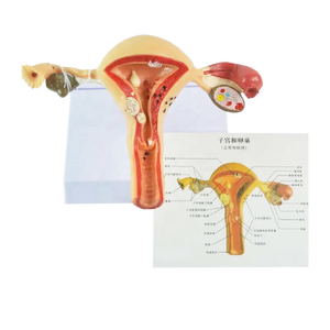 Pathological Model of <strong>Uterus</strong> - Product Image 5