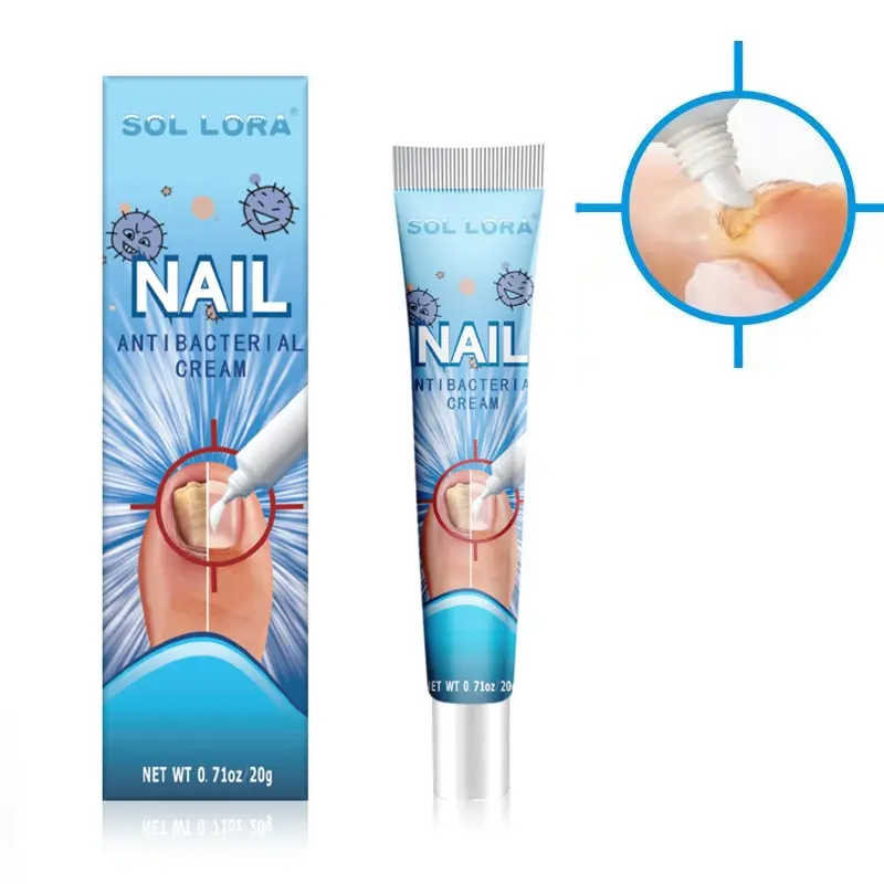 Unha fungo tratamento creme paroníquia onicomicose pomada antibacteriana antifúngica unhas dos pés reparação gesso